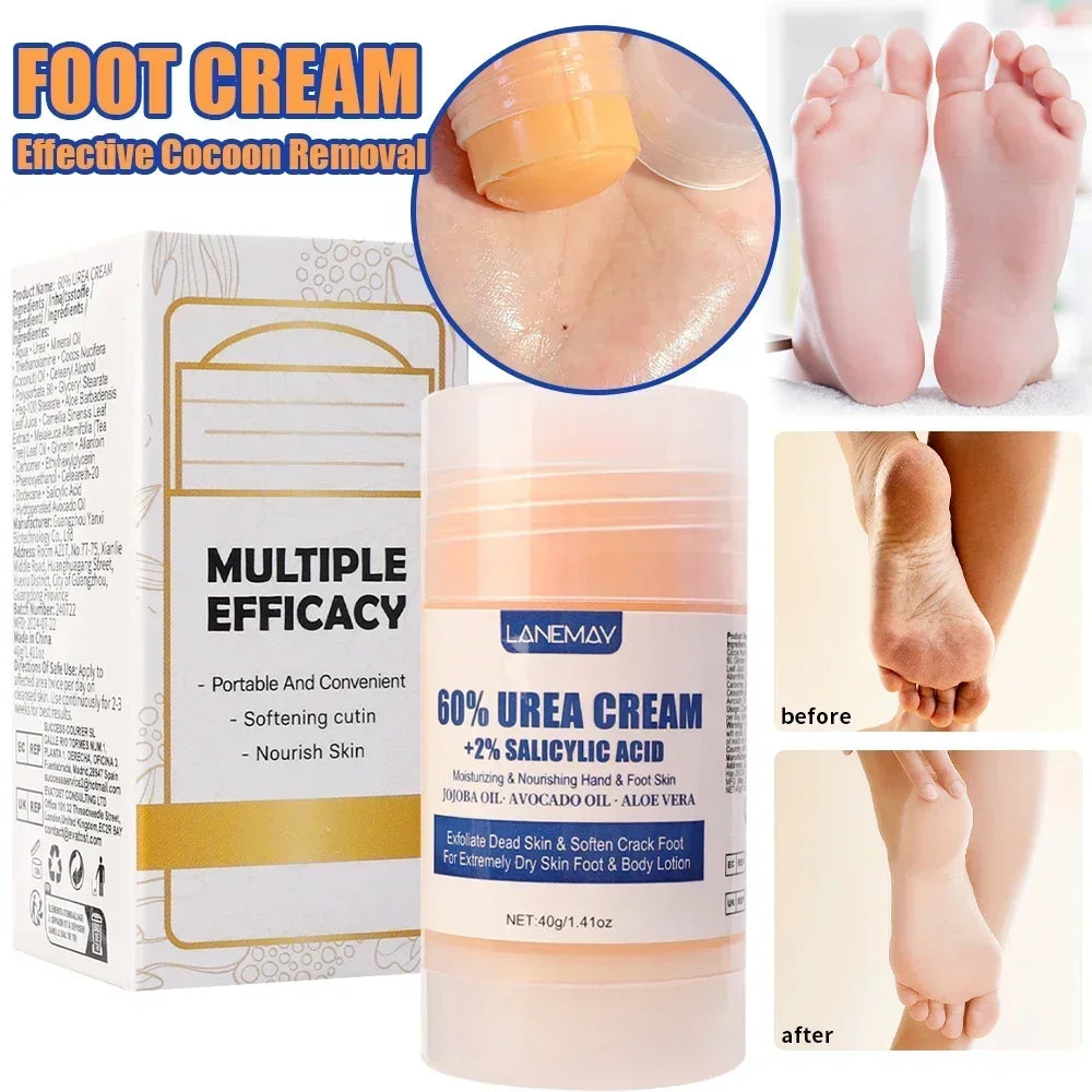 Crème Hydratante en Profondeur pour les Pieds Secs et Craquelés, Talon, Doux, Adoucissant la Peau, Fruité, Soins des Mains et des Pieds, Outils en Bâton, 40g